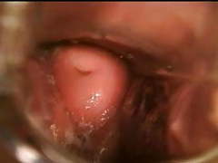 NymphoClips presents: Gyno speculum exam